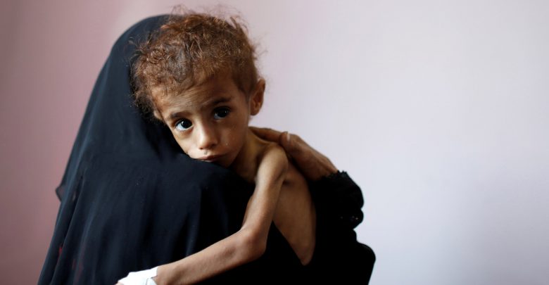 The World’s Worst Humanitarian Crisis: The War in Yemen